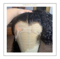 Preparación de frontal